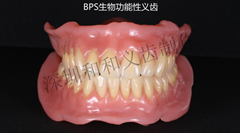 BPS 吸附性义齿